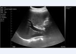 Wifi Handheld Ultrasound Scanner Portable Convex Linear Cardiac Multifrequency
