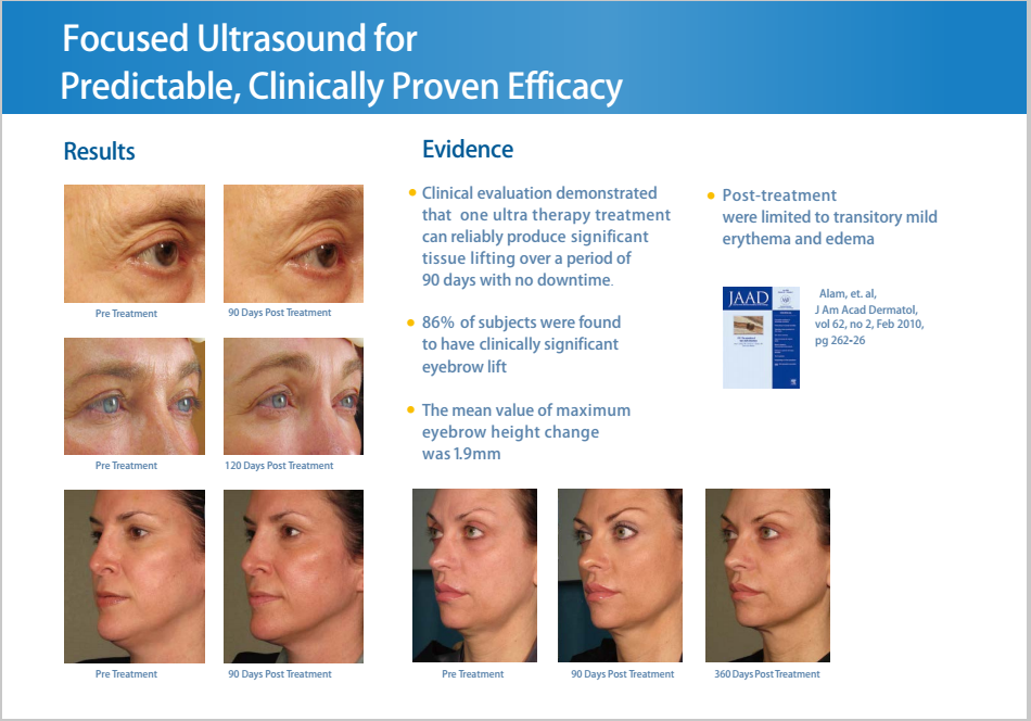 HIFU Face Lifting Machine NBW-HI