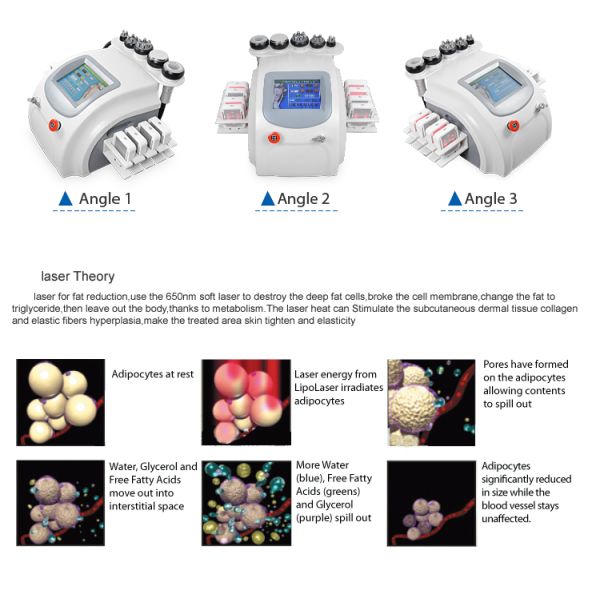 Portable 6 In 1 Body Slimming Machine Cavitation RF LipoLaser 40k Ultrasonic