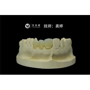 Preshaded 3D Plus Multilayer Dental Zirconia Disc D98 Open System