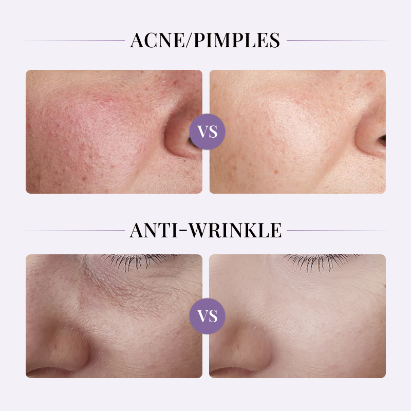 OEM ODM disposable strong hydration nourishing wrinkle removing collagen ointment firming anti wrinkle repair whitening spot removing essence