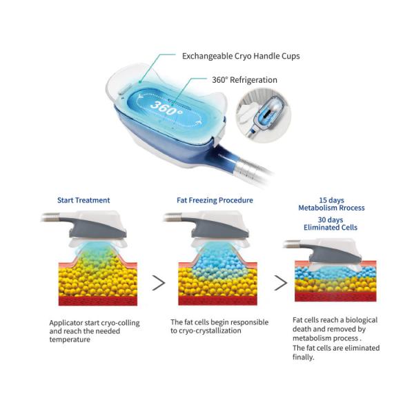 360° Cryolipolysis Fat Freezing CoolSculpting Body Slimming Weight Loss Machine