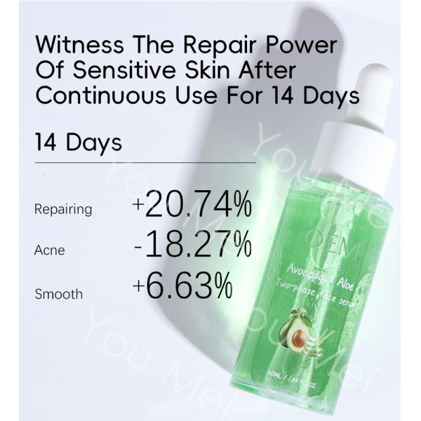 ODM OEM Private Label Skin Care Serum Aloe Vera and Avocado Oil for Acne Control Translucent Brightening and Refining