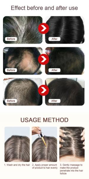100ml Argan Natural Regrowth Hair Serum Hair Care Products For Hair Loss