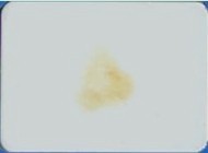 Anti-Scald, Self-Cleaning Nano Aluminium Composite Panel For High-Grade Building Walls