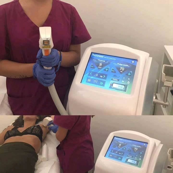 Quality Diode Permanent Hair Removal Laser Machine For Clinic SDL-B 120J/cm2 for sale