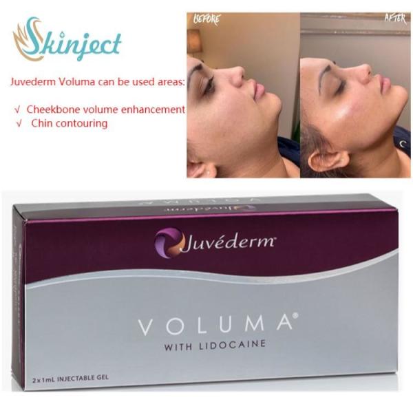 Juvederm Voluma Crosslinked Hyaluronic Acid Filler Long Lasting Face Pure Injectable