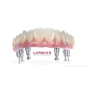 Quality Full Arch Zirconia Malo Bridge for sale