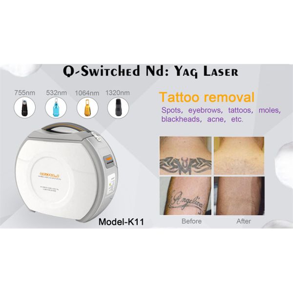 532nm Suitcase Laser Tattoo Removal Machine Q Switched Nd Yag