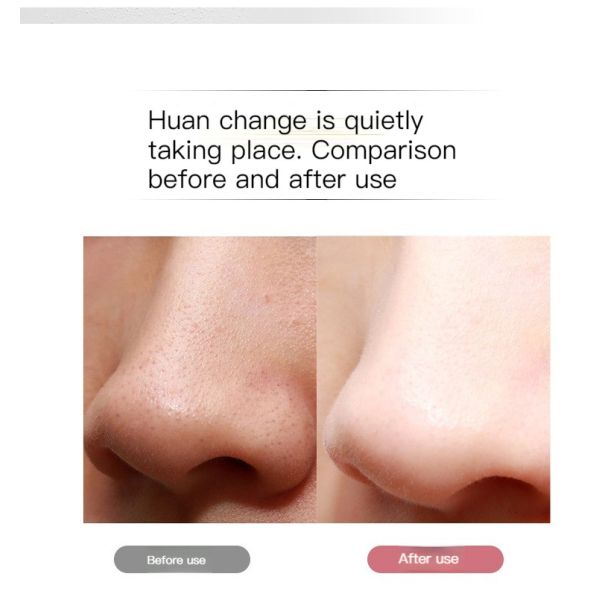 Electricity Ultrasonic Blackhead Remover Deep Face Cleaning Machine Skin Scrubber CE