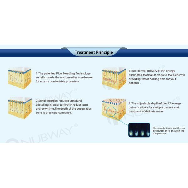2019 high performance nubway in skin fractional rf wrinkle removal with cheap price