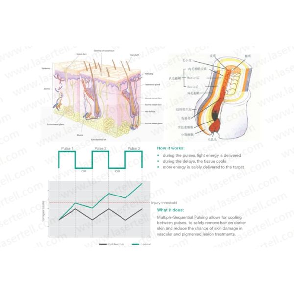 Women Acne Treatment Machine , Fractional Laser Bbeauty Machine for Hair Removel