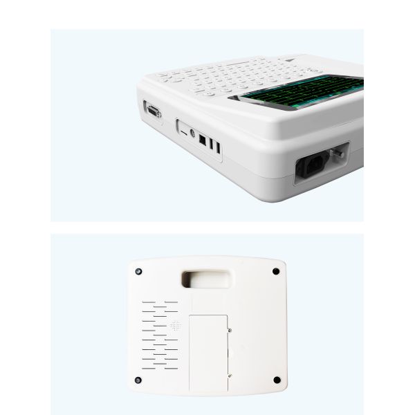 Medical Printer Touch Screen ECG Machine 12 Channel