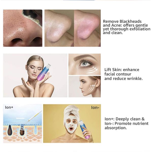 Exfoliator Ultrasonic Skin Facial Beauty Device For Blackhead Removal
