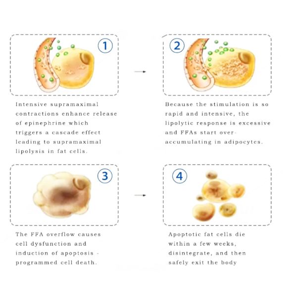 300µS Pulse HI-EMT EMS Sculpting Body Slimming Machine