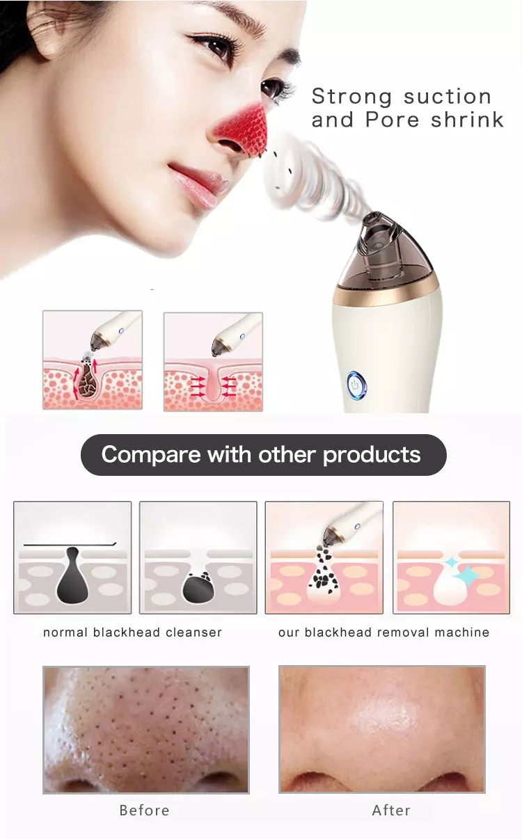 CE 35*40mm Blackhead Remover Machine Pore Sucker Machine Microdermabrasion Head