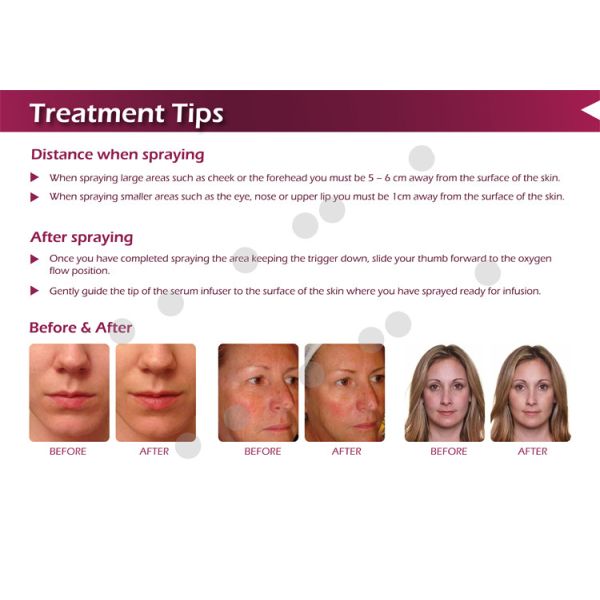 2018 Most popular factory price wholesales multi-function 2MPA hyperbaric oxygen facial machine for sale