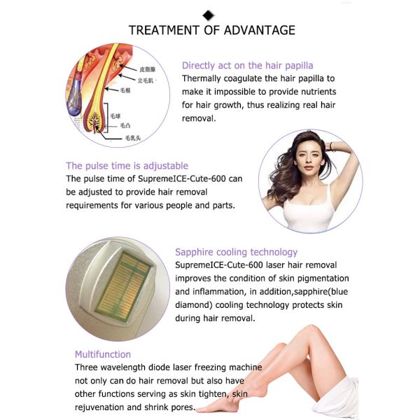 china newest best verticle painfree big spot 3 wavelength smooth skin ce permanent hair removal 755 808 1064 1200w diode